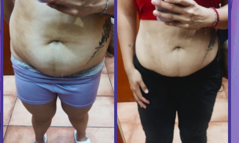 Antes y después de mujer: pérdida de grasa